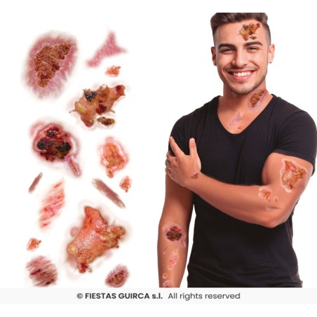 Tatuajes Con Heridas Infectadas
