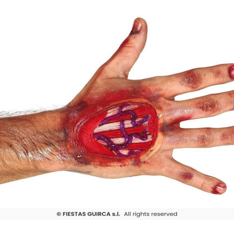 Cicatriz tendones mano 10 cms, latex