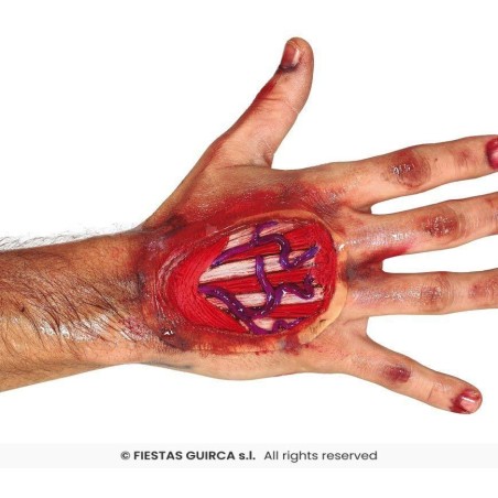 Cicatriz tendones mano 10 cms, latex