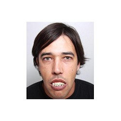 DIENTES BRAKETS 2